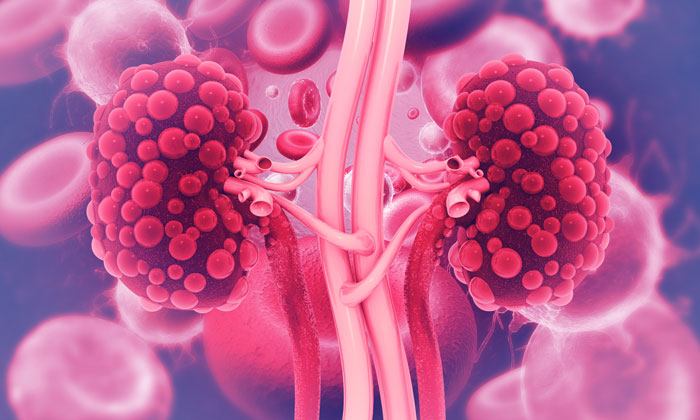 DNA sequencing for kidney disease