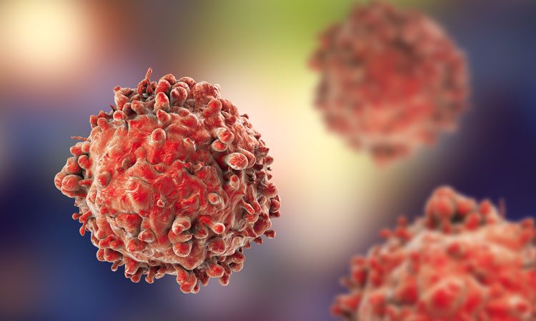 leukemia