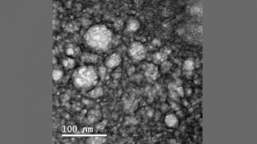 Nanostructured lipid carriers containing docetaxel and functionalized with bevacizumab magnified 100,000 times