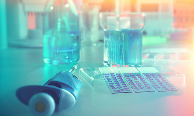 liquid biopsy