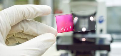 liquid biopsy
