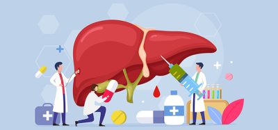 liver cancer