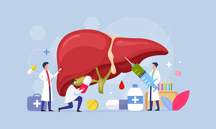 liver cancer