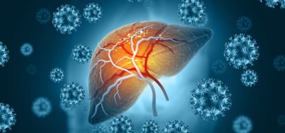 Medically,Accurate,Illustration,Of,Diseased,Liver.,Virus,Infected,Liver.,3d