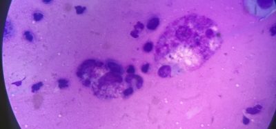 macrophages under microscope