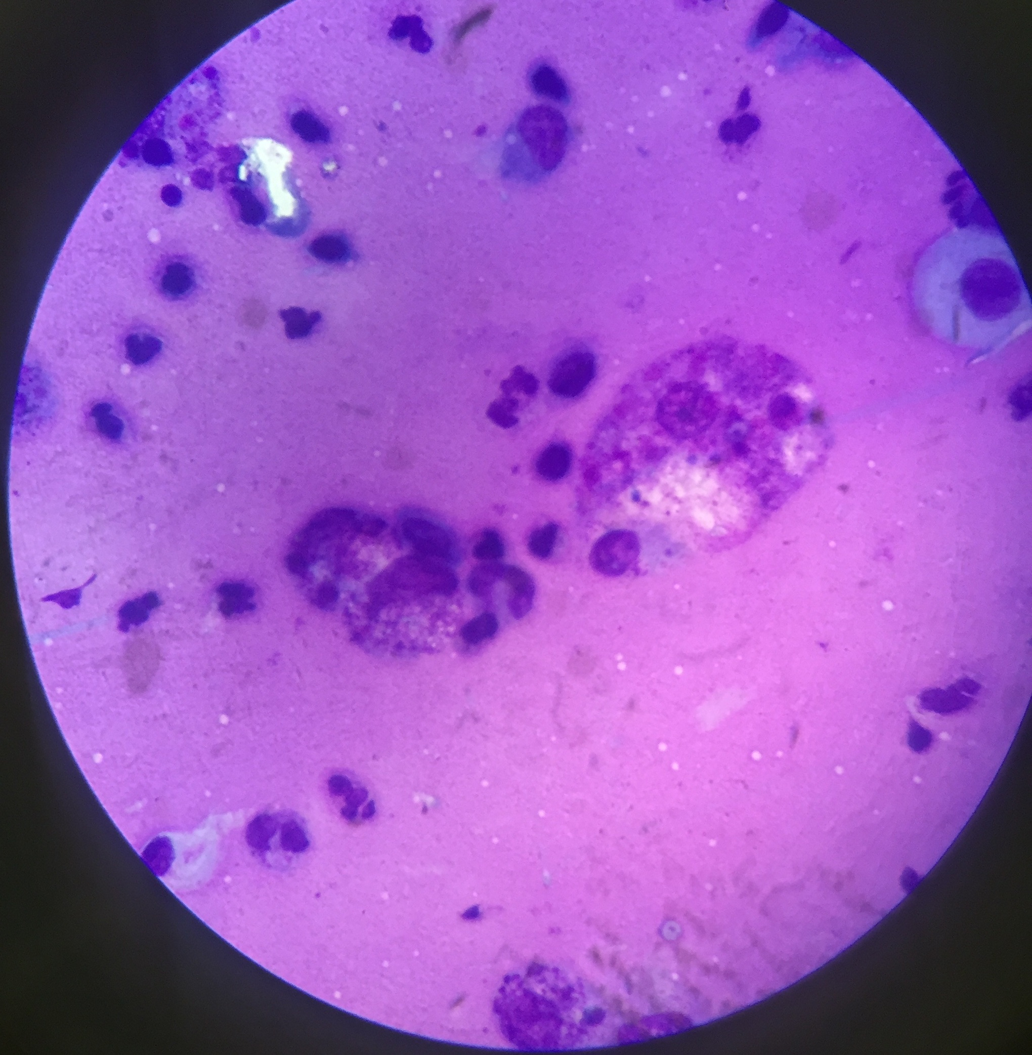 macrophages under microscope