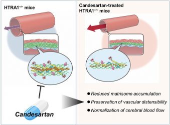 Diagram showing the therapeutic effect of candesartan on cerebral arteriopathy via inhibition of matrisome protein accumulation