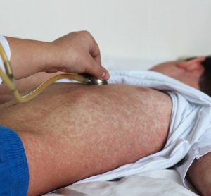 measles virus