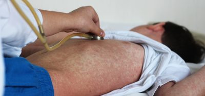 measles virus