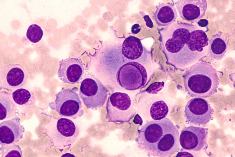 Melanoma cells