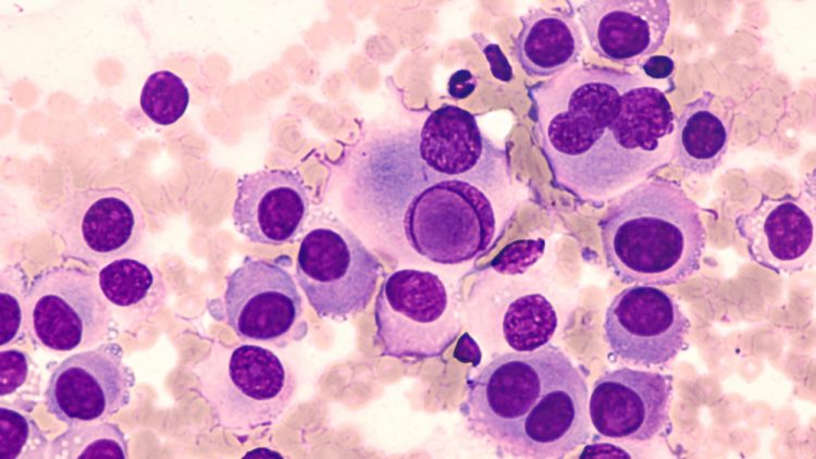 Melanoma cells