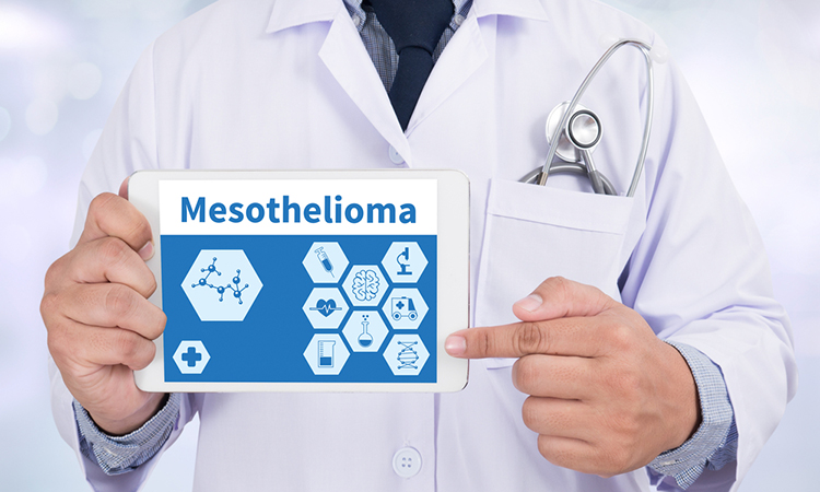 Image showing Mesothelioma Doctor holding digital tablet