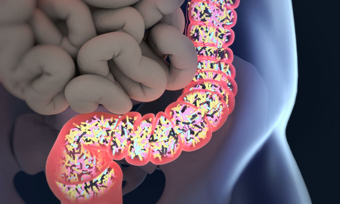 altered gut microbiome