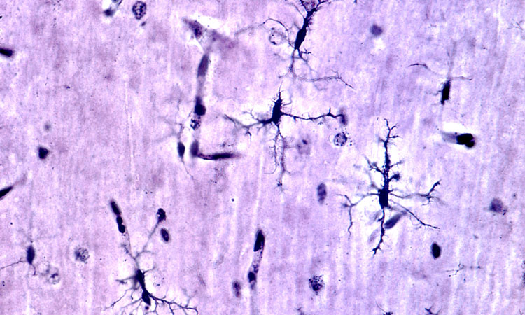 microglia