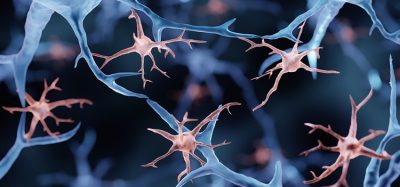 Microglia are immune cells in the brain, 3d illustration