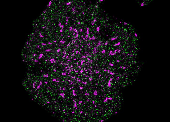 T cell fluorescent microscopy