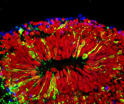 mini-brain infected with Zika virus