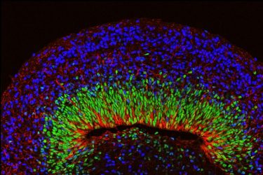 Microscopic image of mini brain organoid