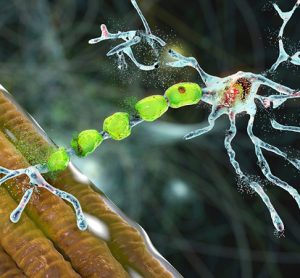 Degradation of motor neurons, conceptual 3D illustration. Motor neuron diseases are a group of neurodegenerative disorders including amyotrophic lateral sclerosis, progressive bulbar palsy and other