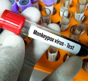 Blood sample tube for Monkeypox virus test