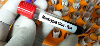 Blood sample tube for Monkeypox virus test