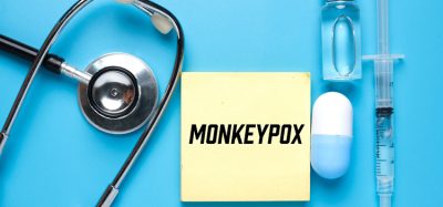 A picture of notepad written monkeypox, stethoscope ,medicine and vaccine. Monkeypox is virus transmitted to humans from animals with symptoms very similar to smallpox.