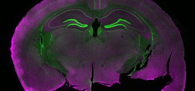 Light microscopy image of a fluorescently labelled section of a mouse brain.