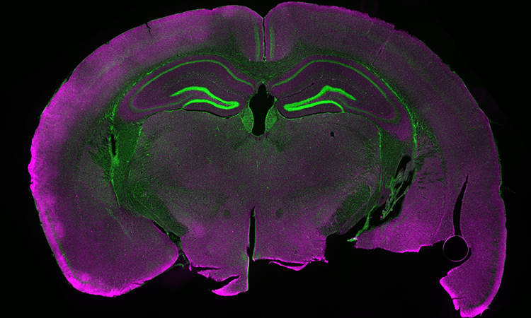 Light microscopy image of a fluorescently labelled section of a mouse brain.