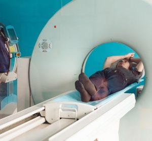 prostate cancer