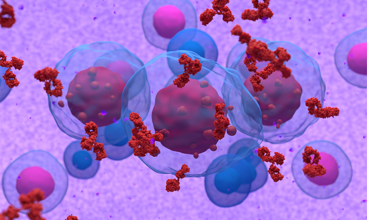 Abnormal plasma cell or b-cell in multiple myeloma emitting paraprotein 3d illustration