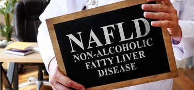 Non-alcoholic fatty liver disease NAFLD the doctor is holding a sign.