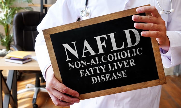 Non-alcoholic fatty liver disease NAFLD the doctor is holding a sign.