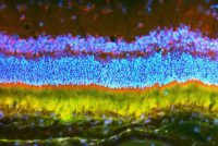 In experiments in rats and mice, two Johns Hopkins scientists -- an engineer and an ophthalmologist -- report the successful use of nanoparticles to deliver gene therapy for blinding eye disease. A uniquely engineered large molecule allows researchers to compact large bundles of therapeutic DNA to be delivered into the cells of the eye [credit: John Hopkins Medicine].