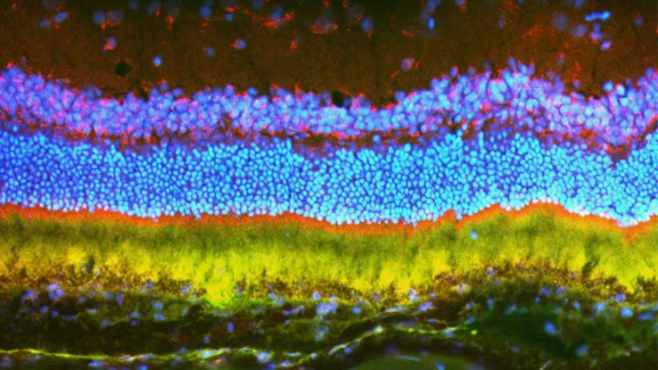 In experiments in rats and mice, two Johns Hopkins scientists -- an engineer and an ophthalmologist -- report the successful use of nanoparticles to deliver gene therapy for blinding eye disease. A uniquely engineered large molecule allows researchers to compact large bundles of therapeutic DNA to be delivered into the cells of the eye [credit: John Hopkins Medicine].