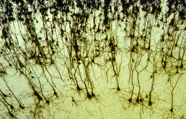 long stringy black fibres on a greyed background