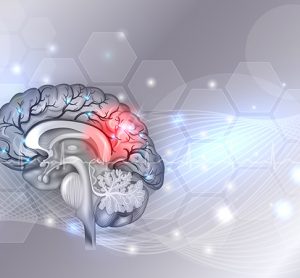Neurodegenerative brain