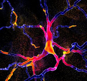 brighly coloured neuron degenerating-neurodegeneration