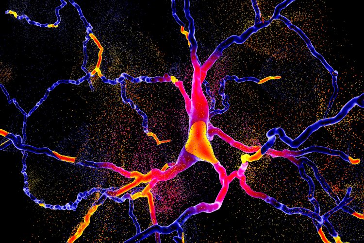 brighly coloured neuron degenerating-neurodegeneration