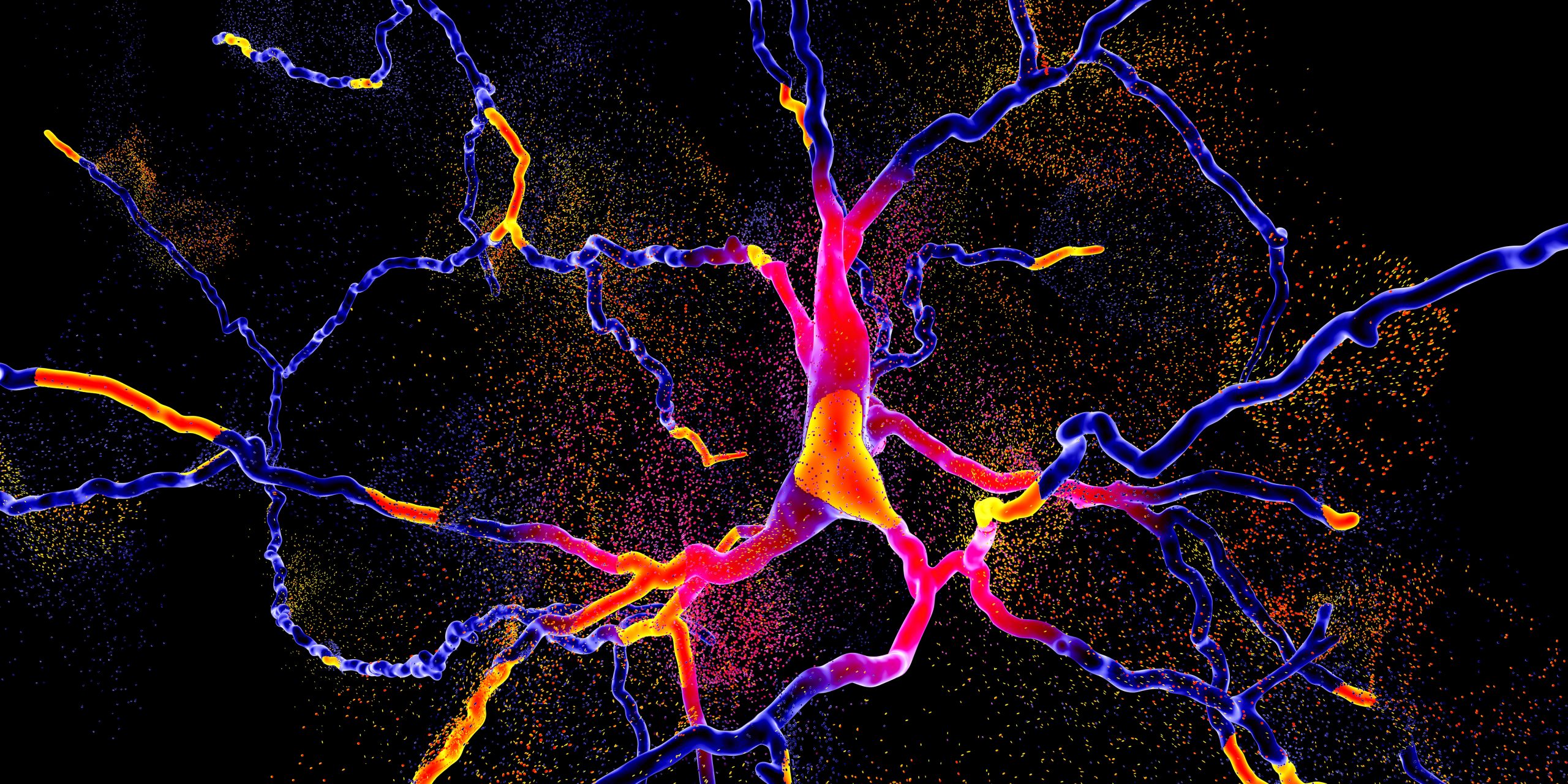 brighly coloured neuron degenerating-neurodegeneration