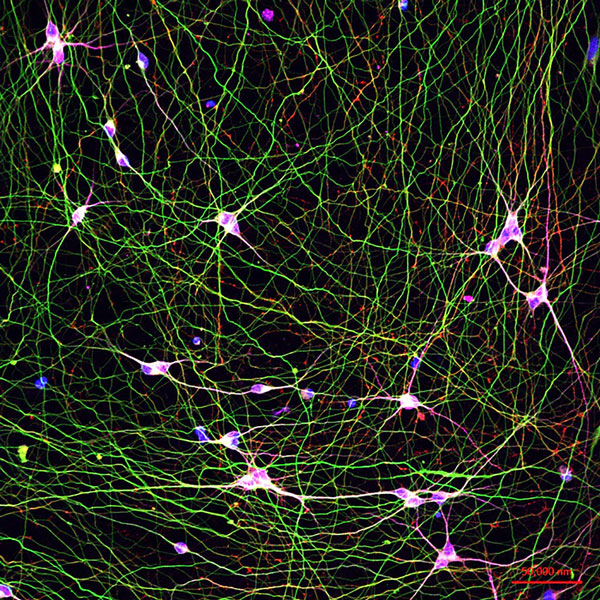 Human stem cell-derived neurons 
