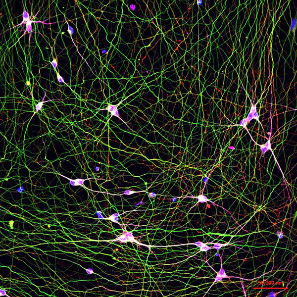 Human stem cell-derived neurons 