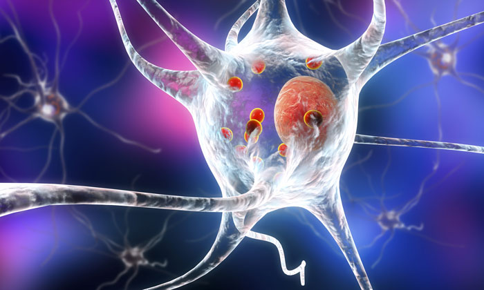 Diverse Parkinson’s-related disorders may stem from different strains of same protein