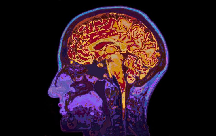 sagittal (side through view) magnetic resonance image of the brain with skull and supporting structures in purple and brain and brainstem in red and orange