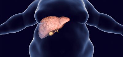 Obese man with fatty liver, 3D illustration. Conceptual image for non-alcoholic fatty liver disease