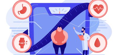 Tiny,People,,Overweight,Man,On,Scales,And,Doctor,Showing,Obesity
