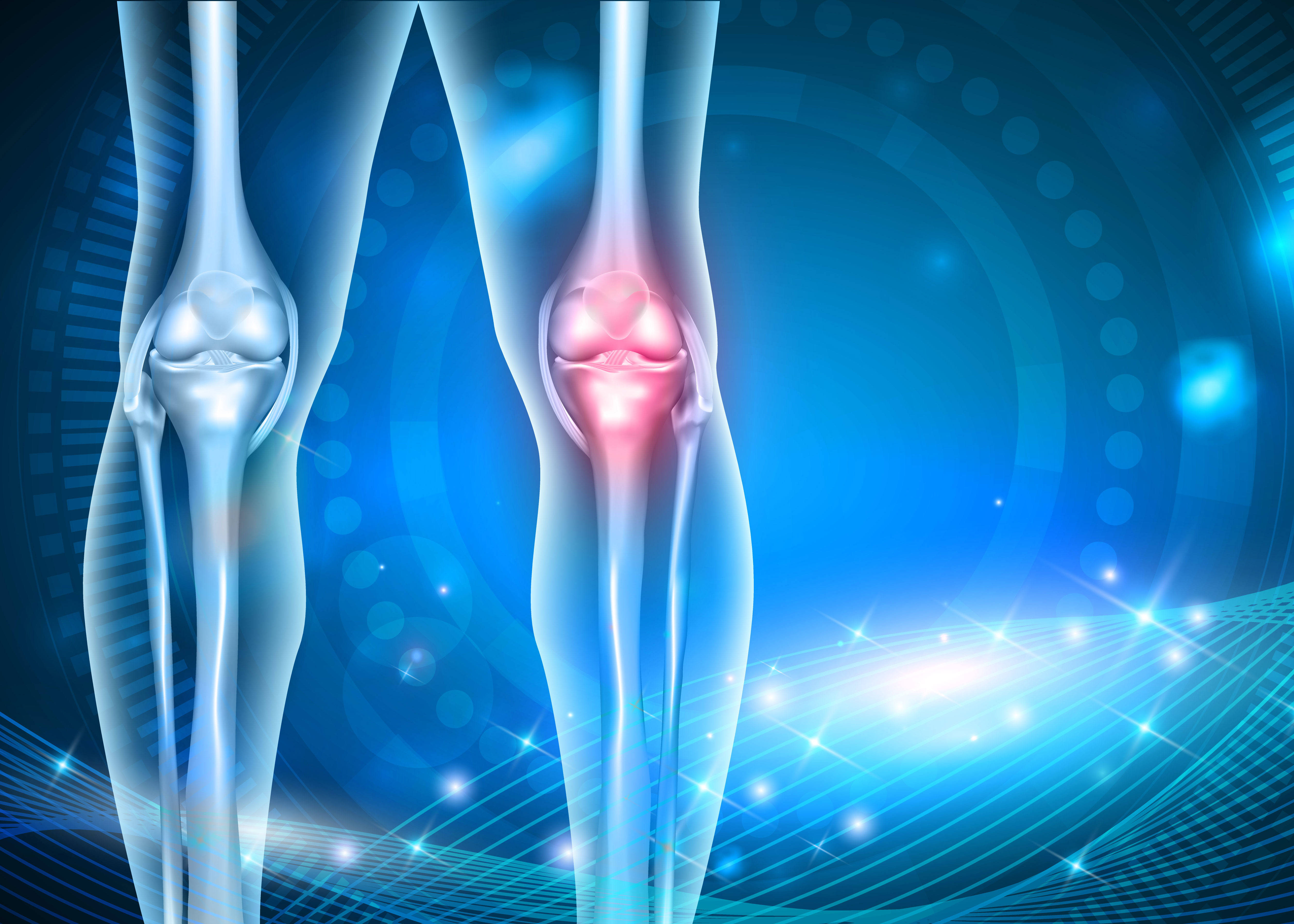 osteoarthritis