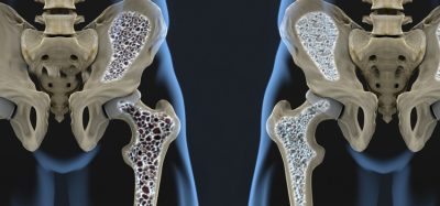 New target for treating conditions that weakens bones, such as osteoporosis.