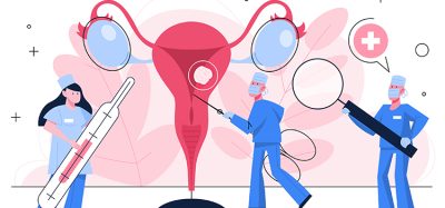 ovarian cancer