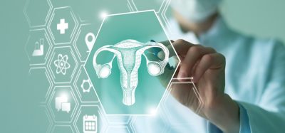 ovarian cancer
