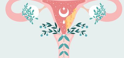 ovarian cancer